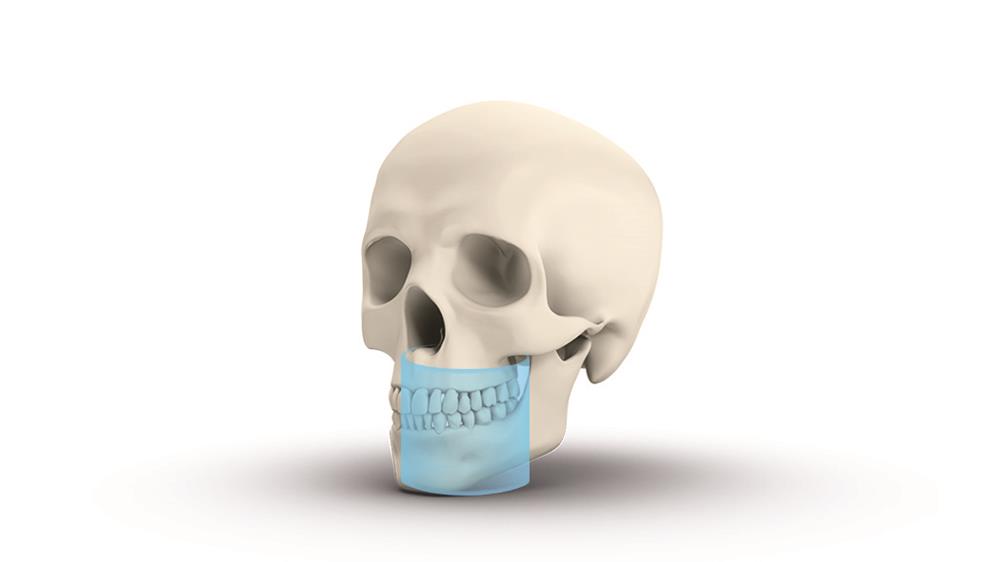 Томограф Orthopantomograph DEXIS OP 3D Pro область 3D сканирования 8x15 см - Instrumentarium Dental, PaloDEx Group Oy
