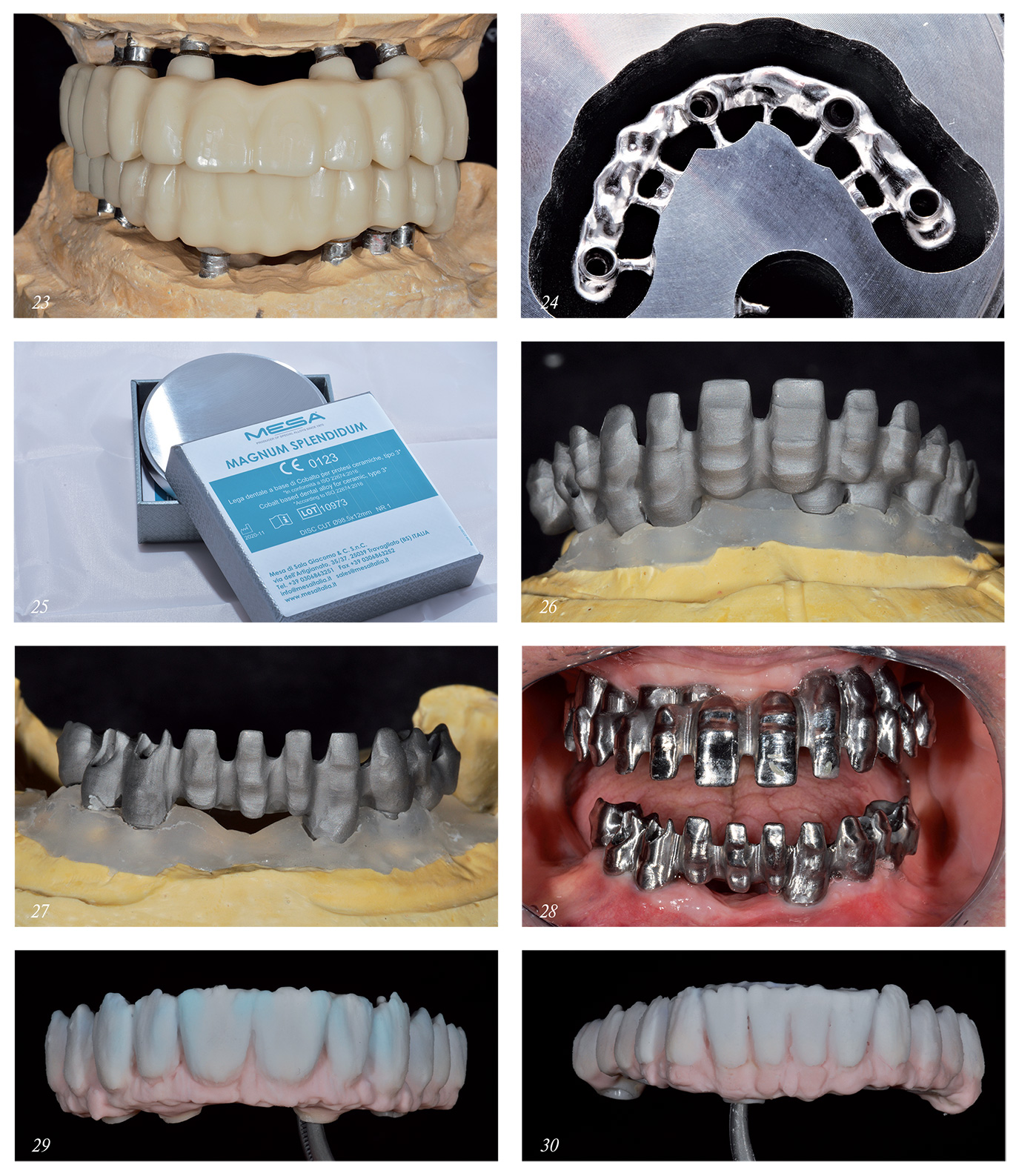 Сплавы стоматология